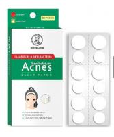 Miếng Dán Mụn Acnes